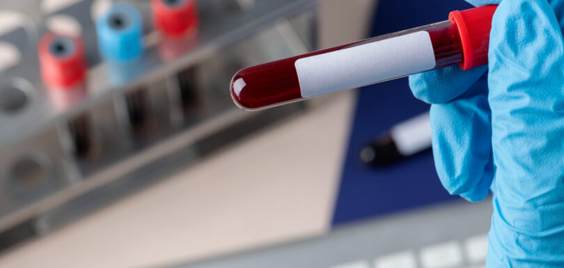 Drink Driving Charge