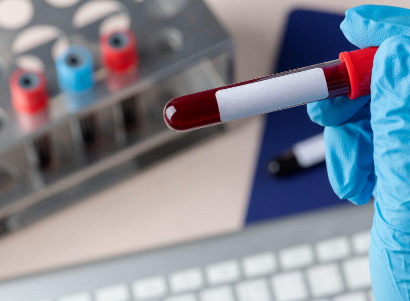 Drink Driving Charge